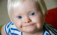 Otizm Hastalığı Belirtileri ve Tedavisi