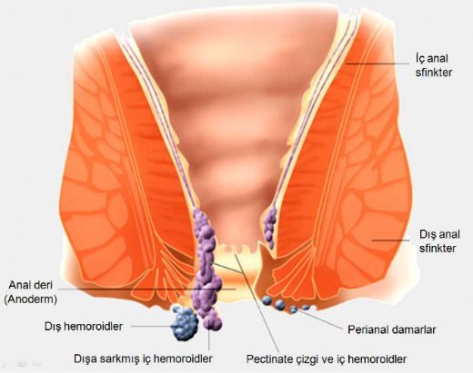 Anüs Hastalıkları Belirtileri ve Tedavisi