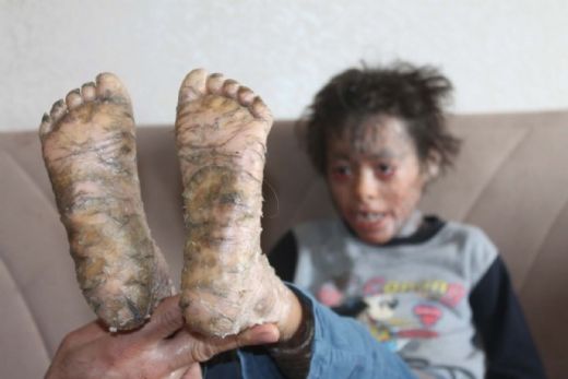 Balık Hastalığı Belirtileri ve Tedavisi