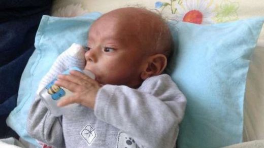 Cam Hastalığı Belirtileri ve Tedavisi