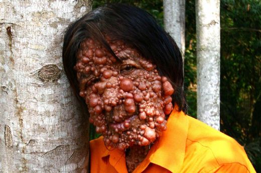 Değişik Hastalıklar Nelerdir?