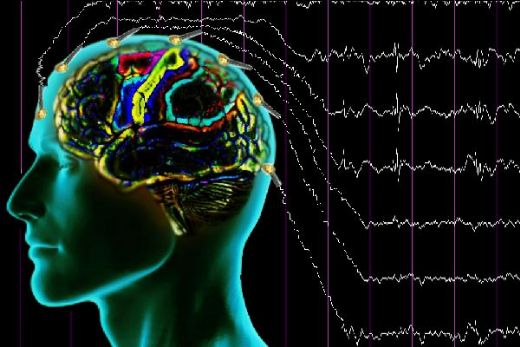 Epilepsi Hastal