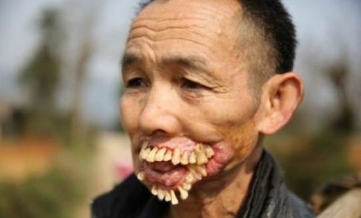 Garip Hastalıklar Belirtileri ve Tedavisi