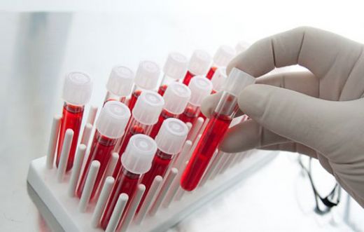 Kan Hastalıkları Nelerdir?