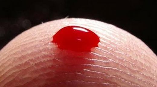 Kanama Hastalığı Belirtileri ve Tedavisi