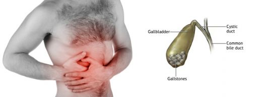 Safra Hastalıkları Belirtileri ve Tedavisi