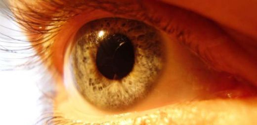 Sarı Hastalığı Belirtileri ve Tedavisi